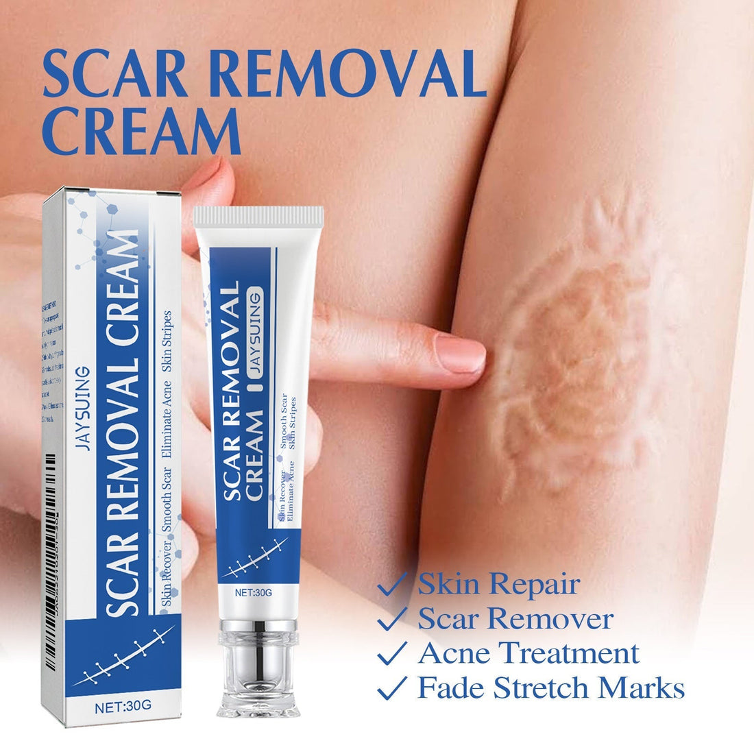 Natural Scar Removal Cream: Advanced Herbal Repair for Surgical Scars, Acne Marks & Stretch Marks