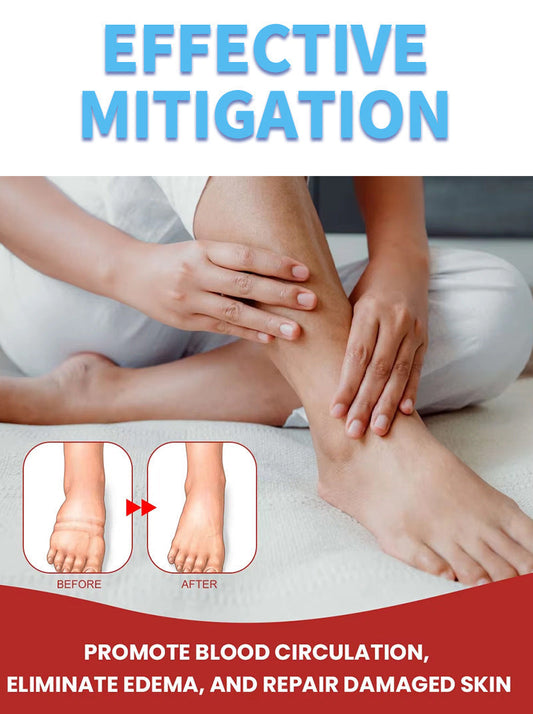 Leg Slimming Massage Cream for soothing swelling and tightening skin