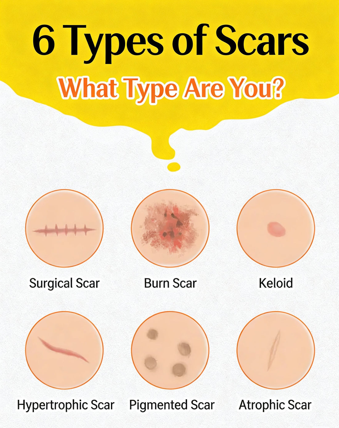The Ultimate Guide to Choosing the Best Scar Removal Cream for Clear, Smooth Skin