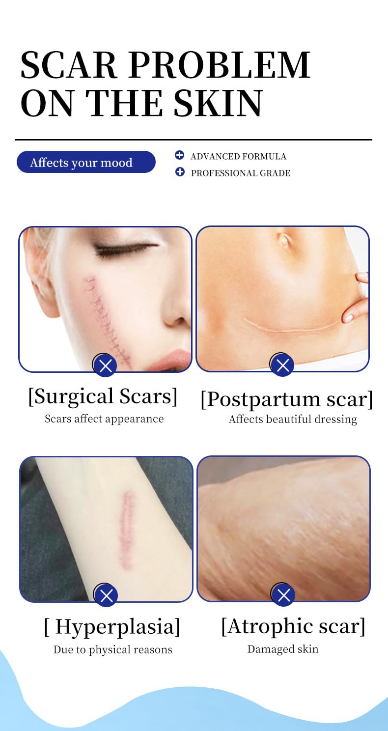 Advanced Medical-Grade Silicone Scar Gel - 1.7 oz Professional Scar Removal Cream for Surgical Scars, C-Section, Keloid Bumps, Stretch Marks, Cruelty-Free & Safe for All Skin Types (1)