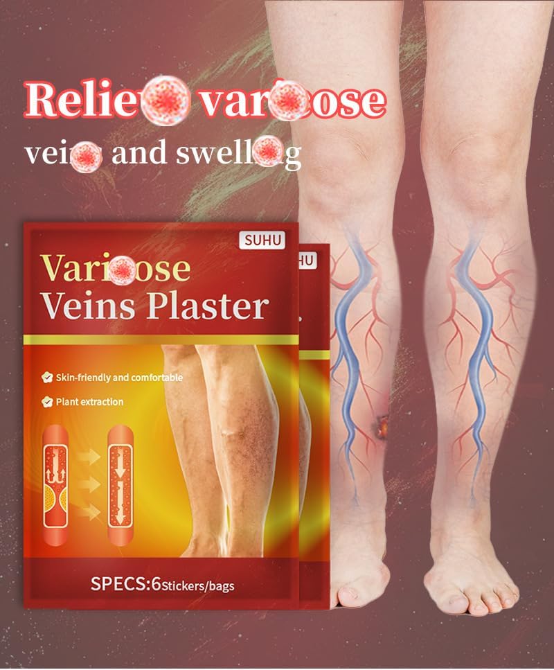 Varicose Veins Relief Plasters, 2 - Pack (12Pcs) for Bulging Veins & Leg Discomfort, Plant - Based, Skin - Friendly