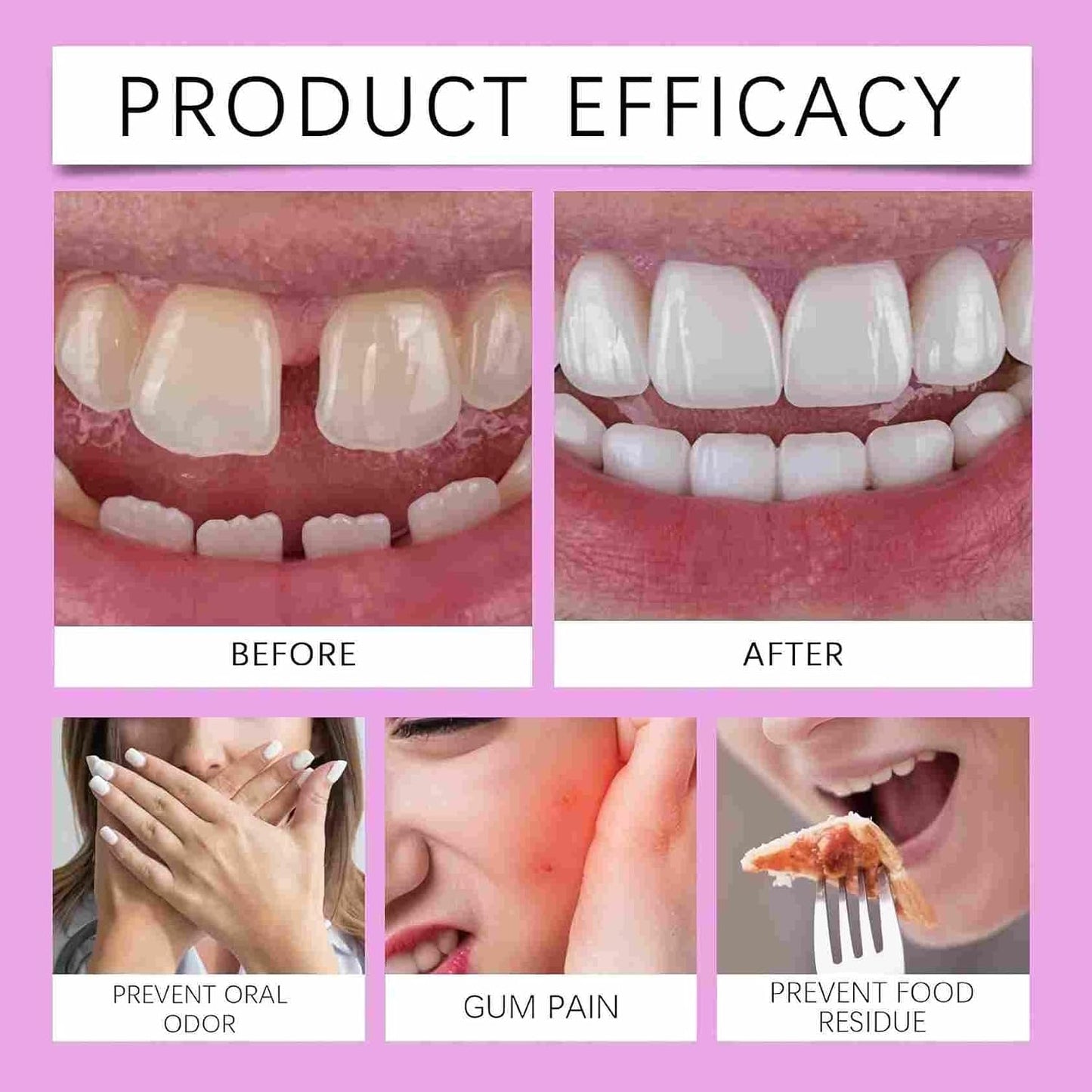 Functional dentures, Adjustable Functional Full-Mouth dentures, Premium Style, Custom-Made Silicone Full-Mouth Denture Set, Premium Style, for Men and Women-2-piece