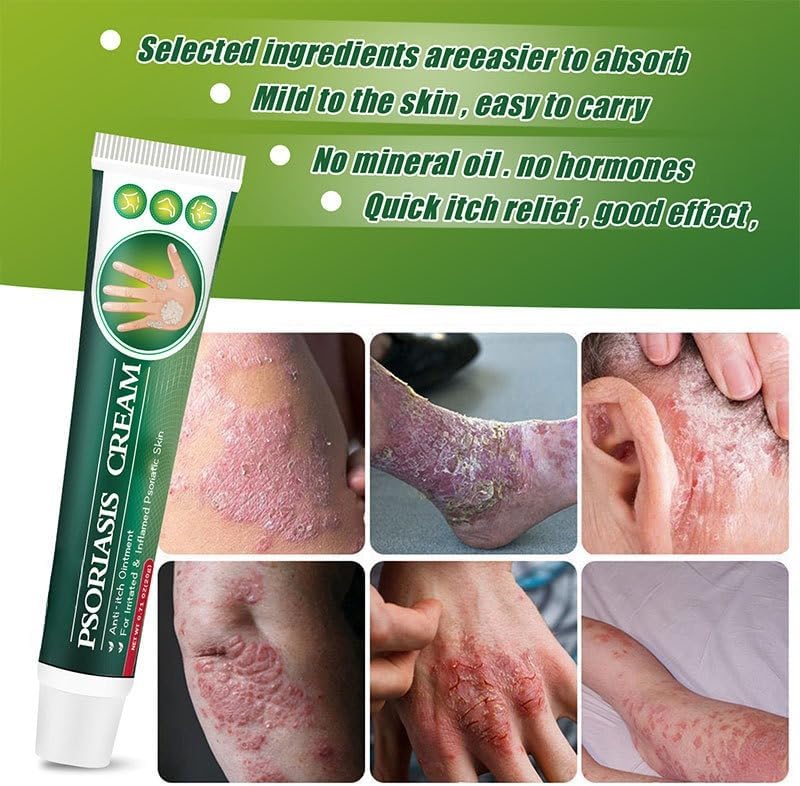Targeted Care Cream for Rough, Flaky Skin - Soothes Hands & Feet with Honeysuckle & Cnidium - Fragrance-Free, Non-Greasy Formula - 2 Pack