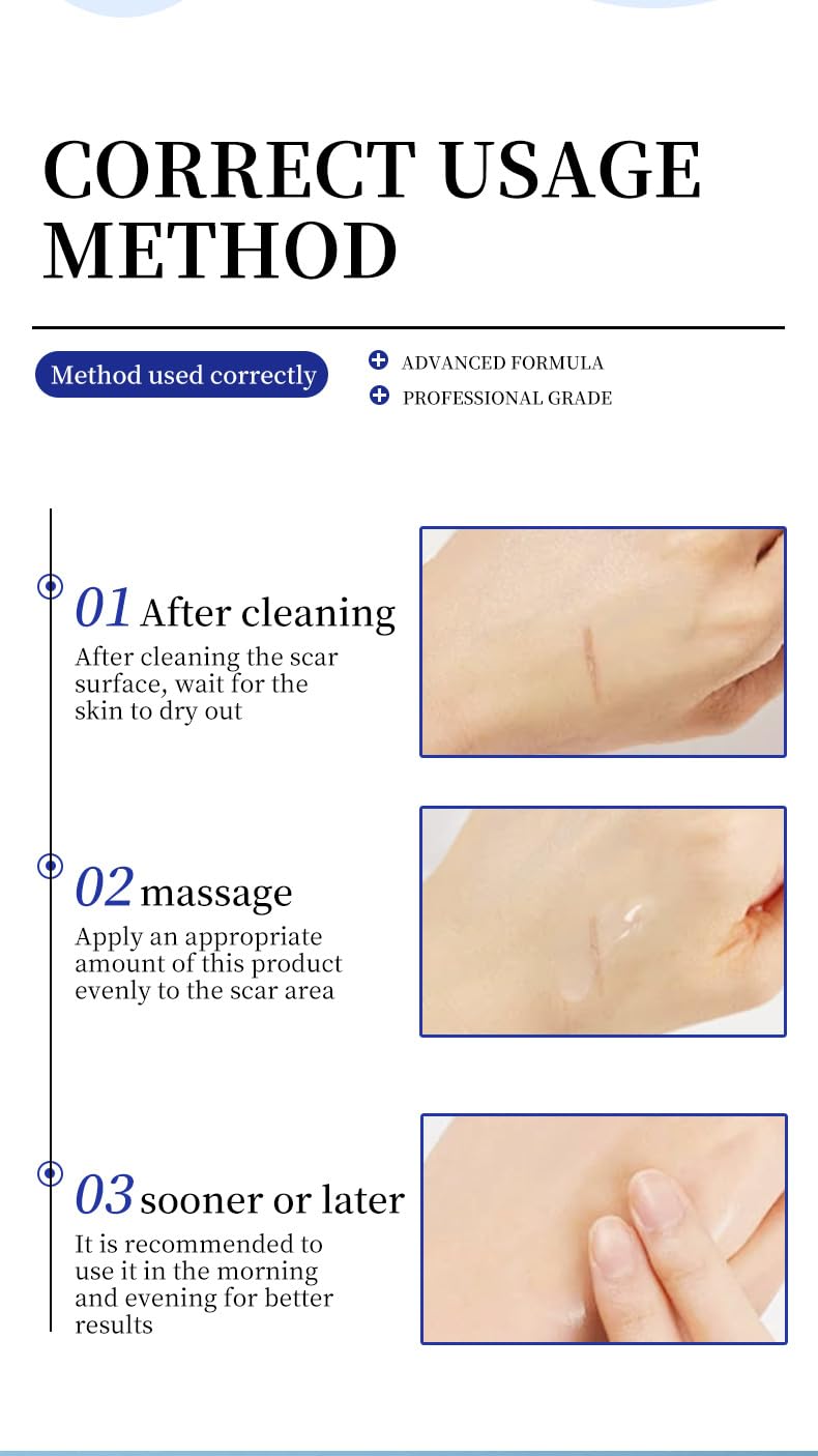 Advanced Medical-Grade Silicone Scar Gel - 1.7 oz Professional Scar Removal Cream for Surgical Scars, C-Section, Keloid Bumps, Stretch Marks, Cruelty-Free & Safe for All Skin Types (1)