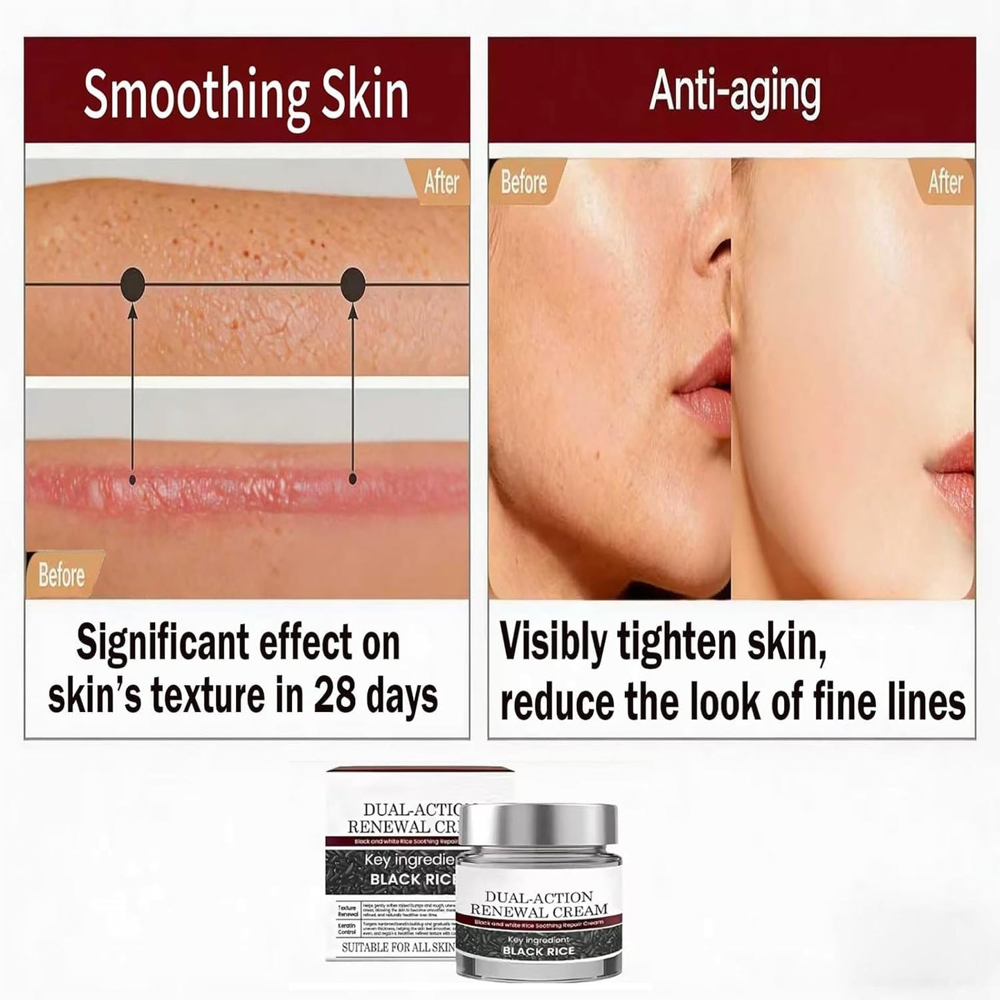 Dual-Action Black & White Rice Moisturizing Cream | Hydrating Body Cream with Rice Bran, Tea Tree Oil & Aloe Vera | Gentle for All Skin Types, 1.76oz x2 Pack