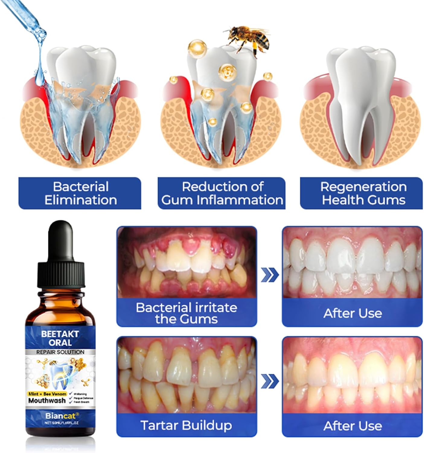 bobojuju Oral Repair Solution, Mint-Flavored mouthwash, Effectively Improves Oral Hygiene and Freshens Breath (4PCS)