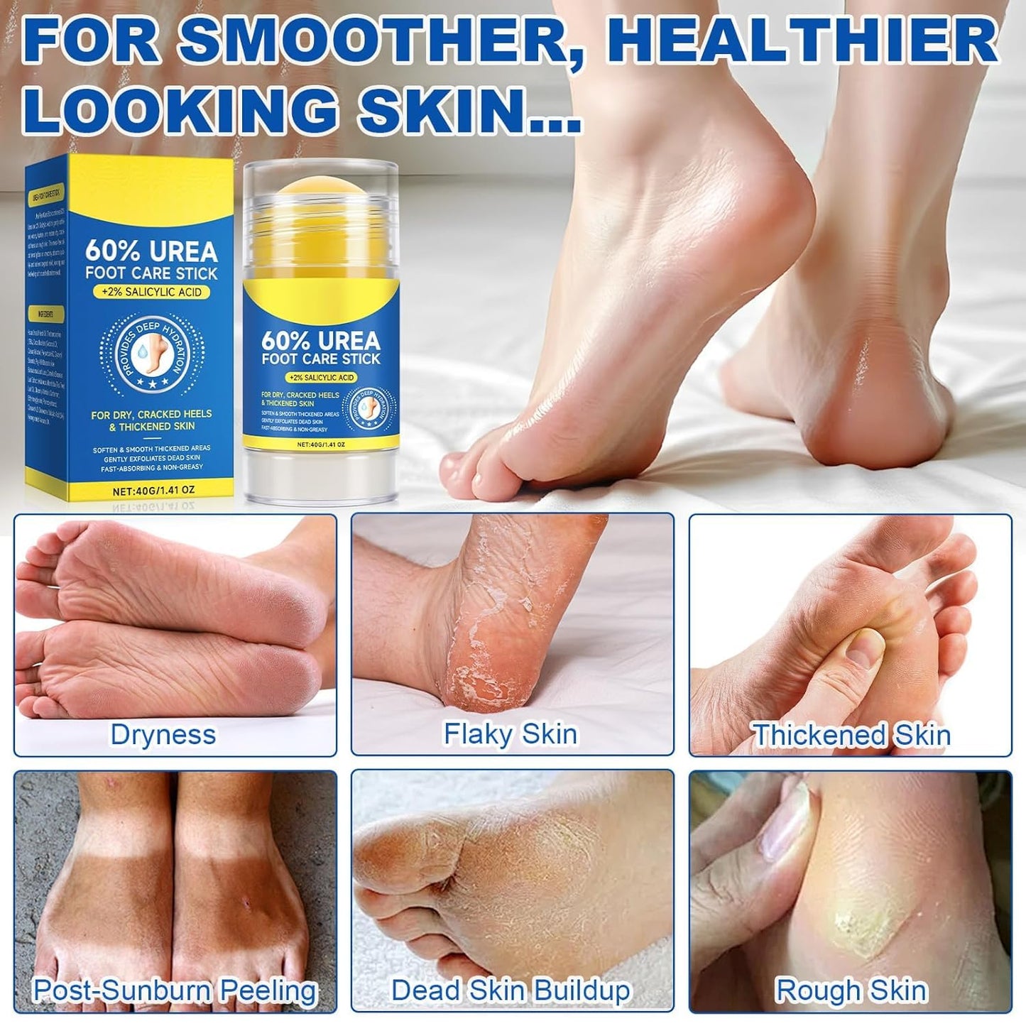 60% Urea Foot Care Stick (with 2% Salicylic Acid) — Moisturizing Foot Cream for Dry Skin on Feet, Knees, Elbows & Hands - Hydrates & Softens Rough Skin (2-Pieces)