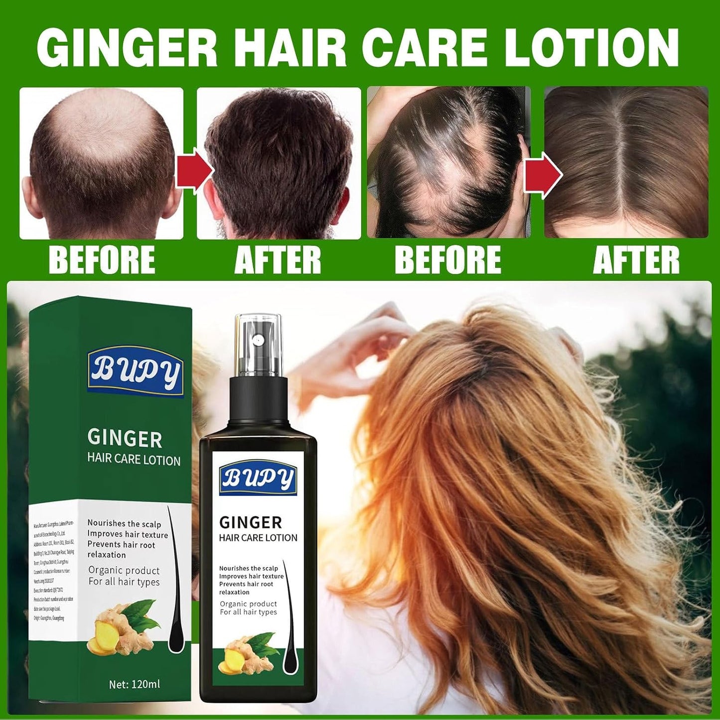 Ginger Scalp Care Lotion Spray 4.06 fl oz, Infused Natural Ginger Extract, Nourish Hair Roots & Strengthen Thin Fragile Strands, Daily Scalp Treatment for Men Women All Hair Types