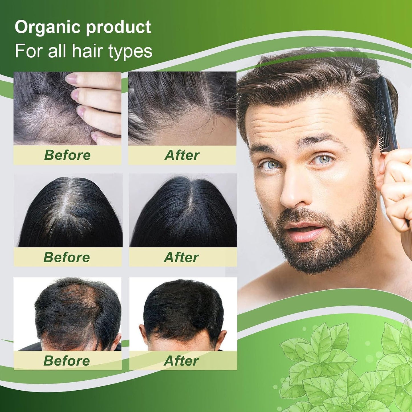Ginger Scalp Care Lotion Spray 4.06 fl oz, Infused Natural Ginger Extract, Nourish Hair Roots & Strengthen Thin Fragile Strands, Daily Scalp Treatment for Men Women All Hair Types