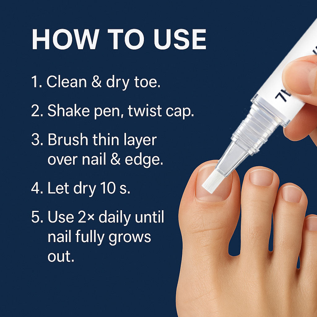 Nail Care Pen (3-Pack) - 25% Undecylenic Acid & Tea Tree Oil, Nourishing Formula for Healthy-Looking Fingernails & Toenails, 3ml per Pen (Pack of 3/4)